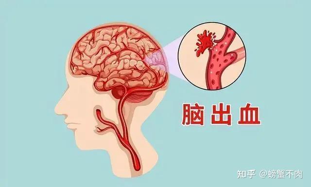 高血压的危害你注意了吗？